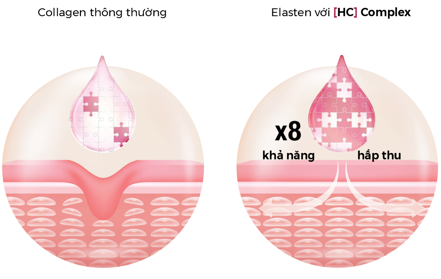 collagen Elasten hc-komplex